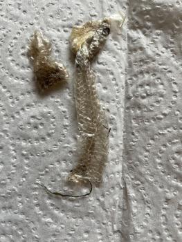 Slowworms shed their skin periodically, leaving the old skin in sections.